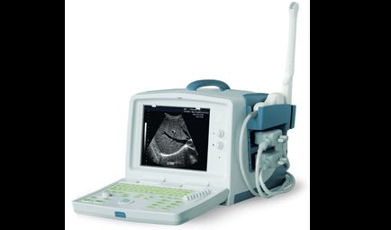 FULL DIGITAL PORTABLE ULTRASOUND SCANNER W CONVEX PROBE  